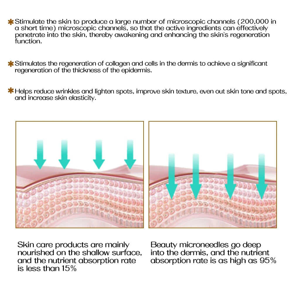 ZGTS 540 Microneedle Roller